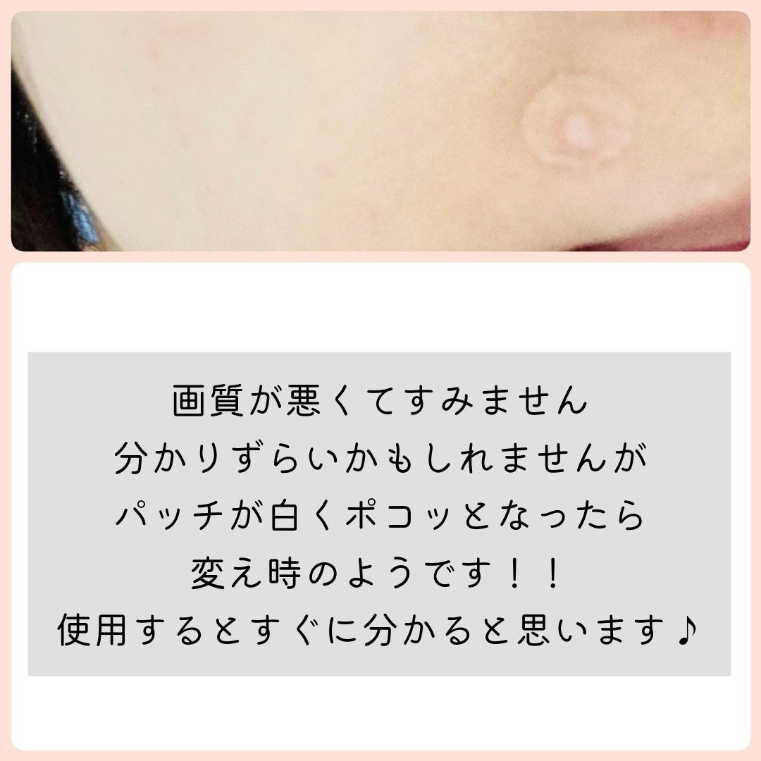 ビューティー スポットパッチ/イージーダムビューティー/にきびパッチを使ったクチコミ(3枚目)