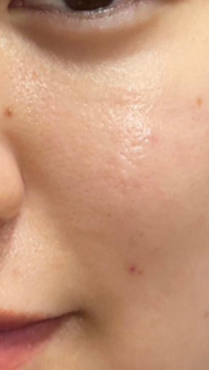 ルルルン ハイドラ V マスク/ルルルン/シートマスク・パックを使ったクチコミ(1枚目)