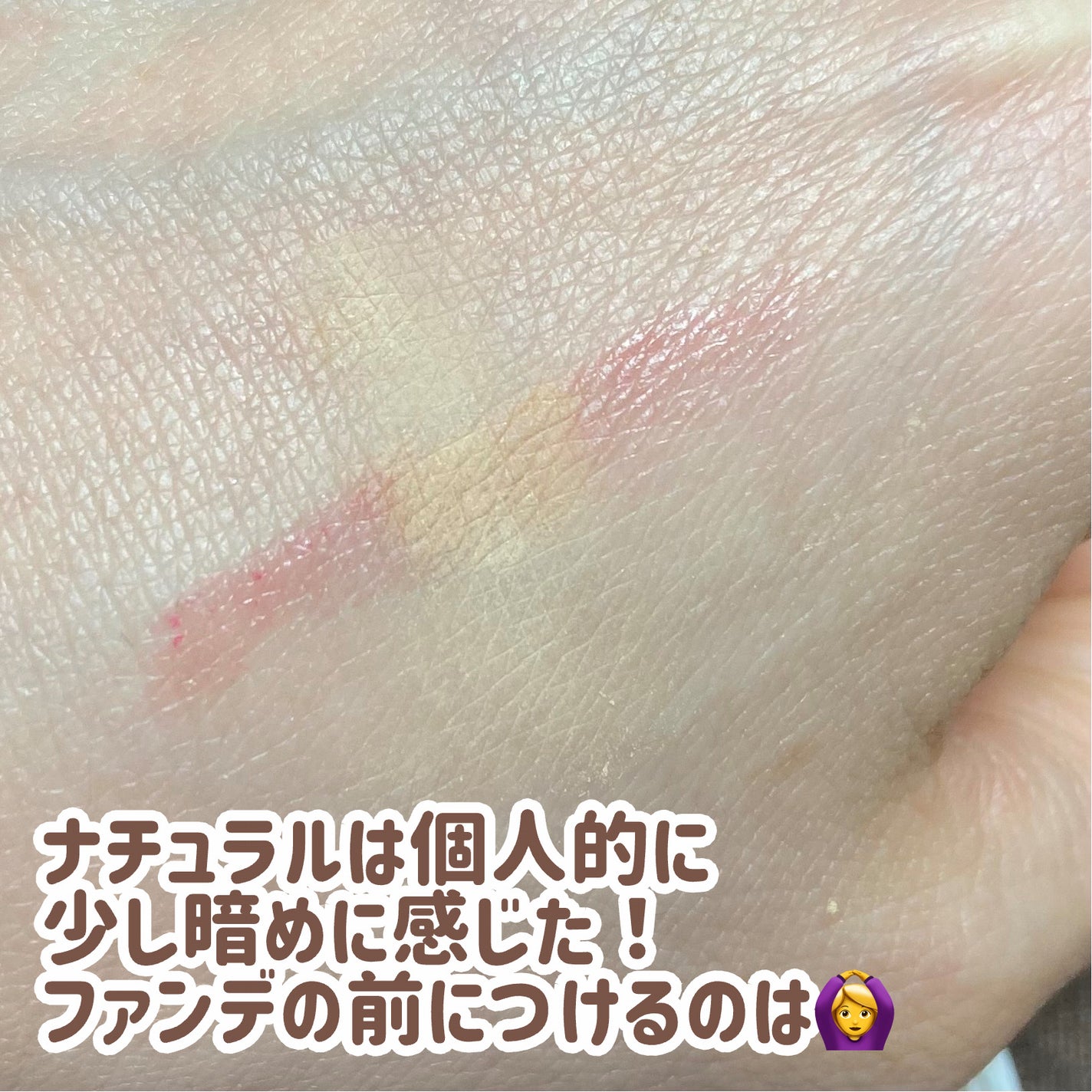 薬用コンシーラー アクネプロテクター/ONLY MINERALS/パウダーコンシーラーを使ったクチコミ(4枚目)