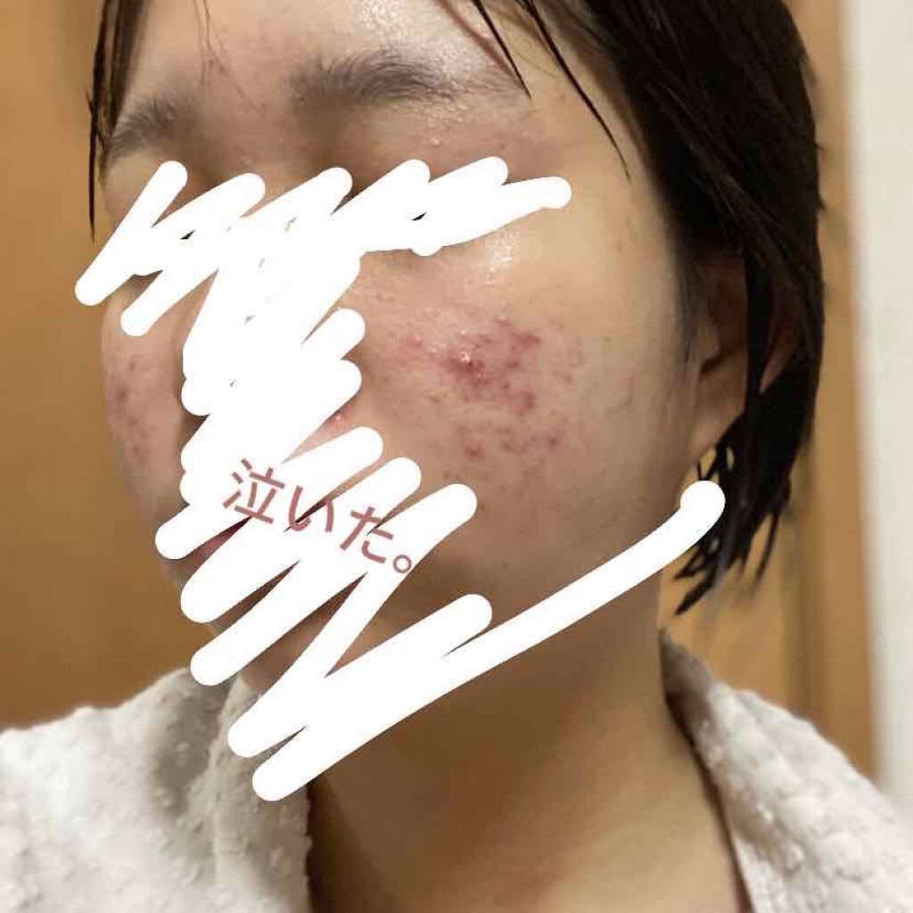 明色美顔水 薬用化粧水/美顔/化粧水を使ったクチコミ(3枚目)