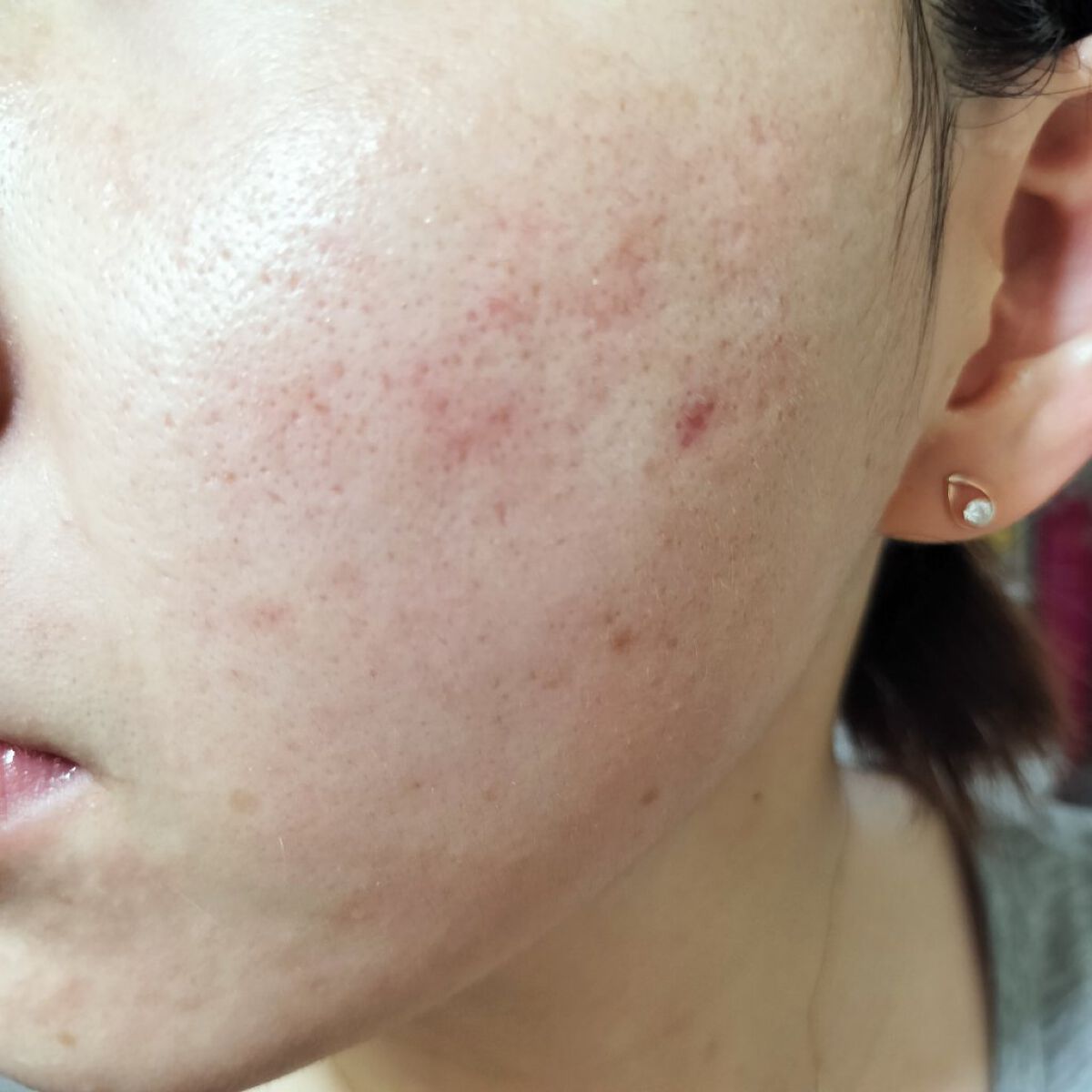 vitamin c suspension 30% in silicone/The Ordinary/美容液を使ったクチコミ（2枚目）