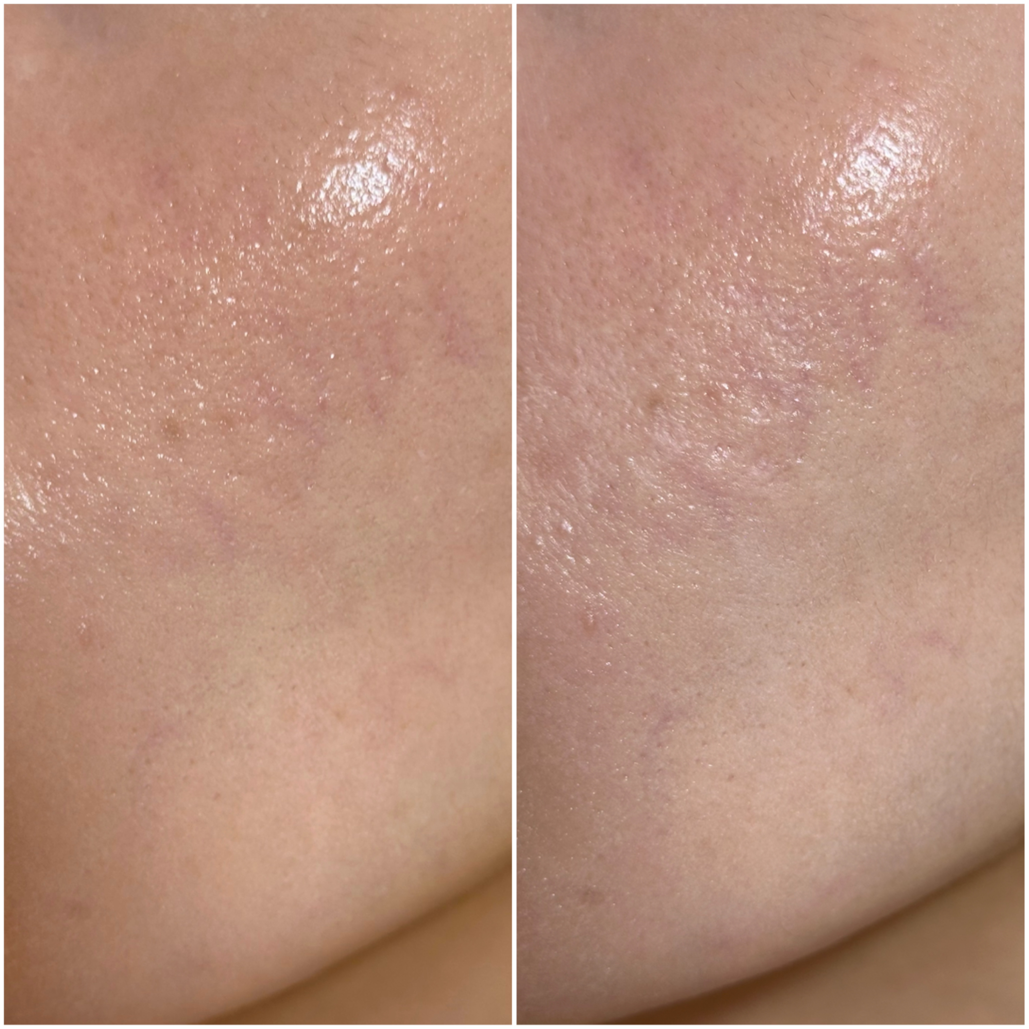 プリズム・リーブル/GIVENCHY/ルースパウダーを使ったクチコミ（3枚目）