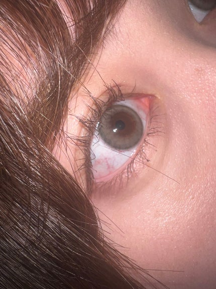 ã©ãã·ã¥ãã©ãŒããŒEXïŒãã³ã°WPïŒ/KATE/ãã¹ã«ã©ã䜿ã£ãã¯ãã³ãïŒ7æç®ïŒ