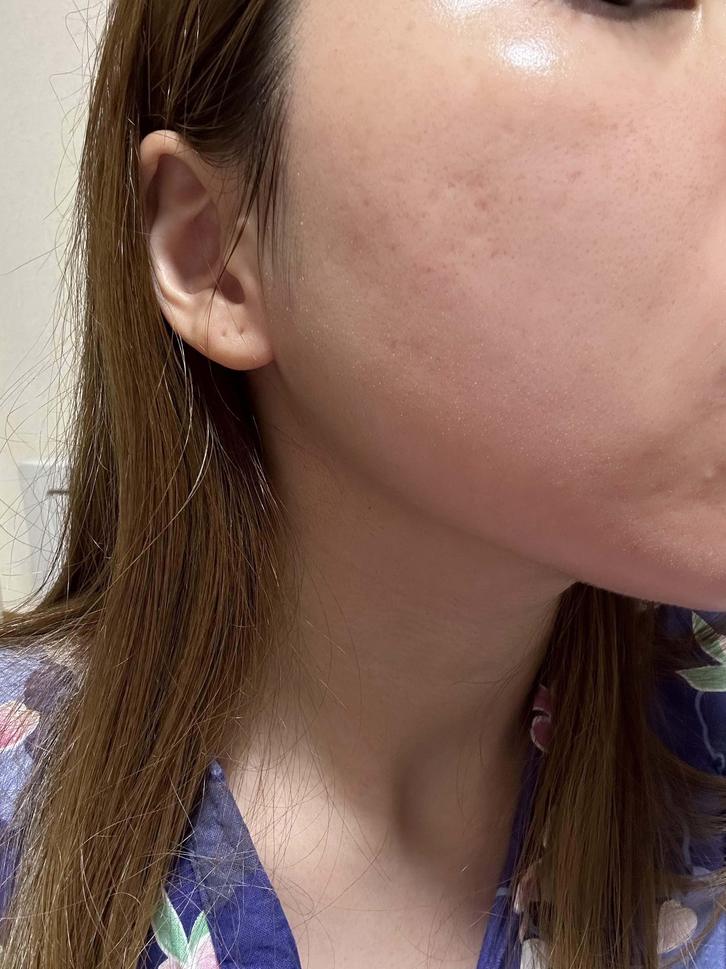  ビタプル リペア エッセンスローション/VITAPURU/化粧水を使ったクチコミ（2枚目）