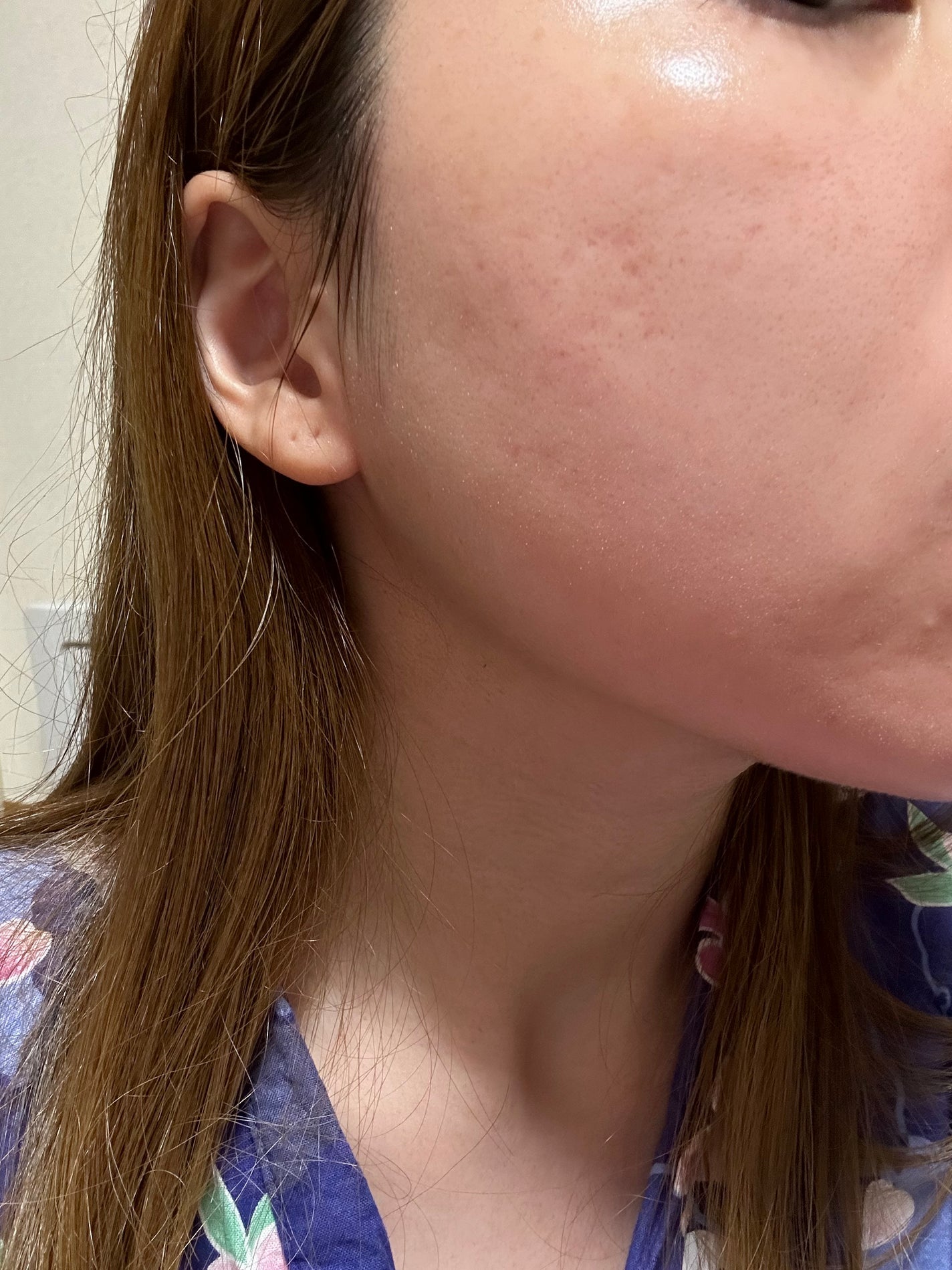 ビタプル リペア エッセンスローション/VITAPURU/化粧水を使ったクチコミ(2枚目)