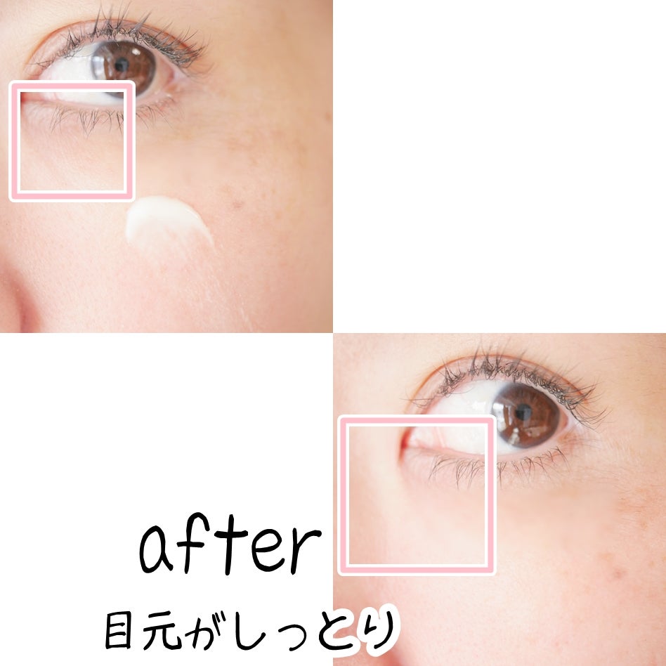 SOOTHING REPAIR TONING SERUM R4/ダーマファーム/美容液を使ったクチコミ(6枚目)