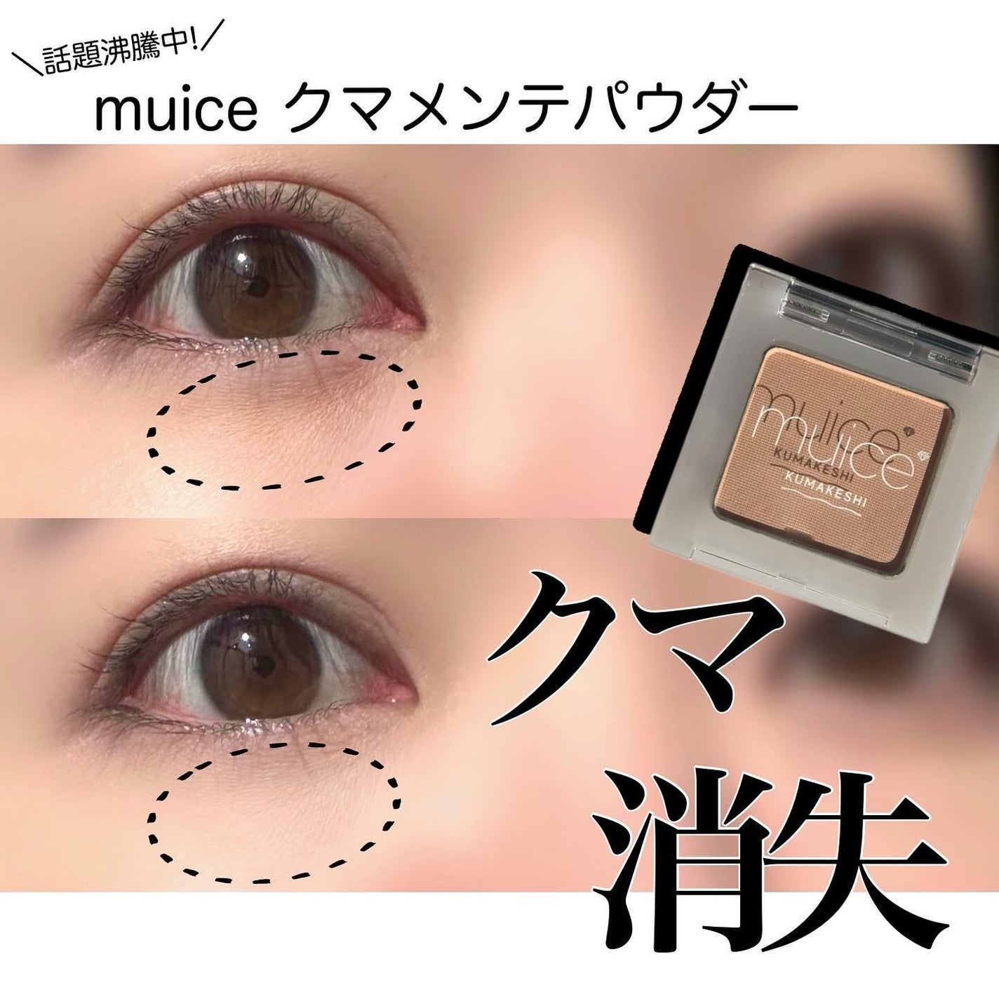 クマメンテパウダー/muice/パウダーコンシーラーを使ったクチコミ(1枚目)