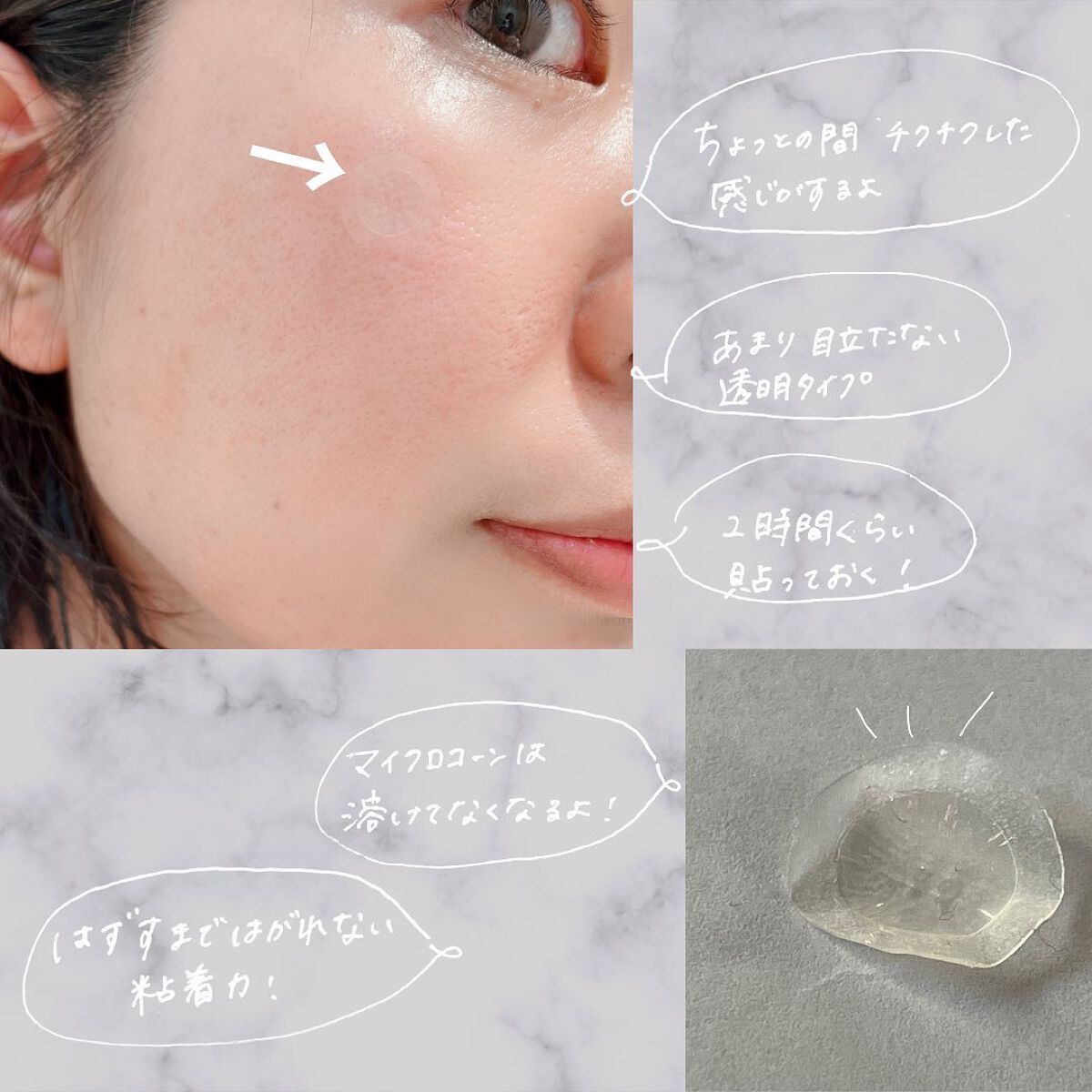 ビタミン レチノール リペア マイクロ スポット パッチ/BIOHEAL BOH/その他スキンケアを使ったクチコミ(6枚目)