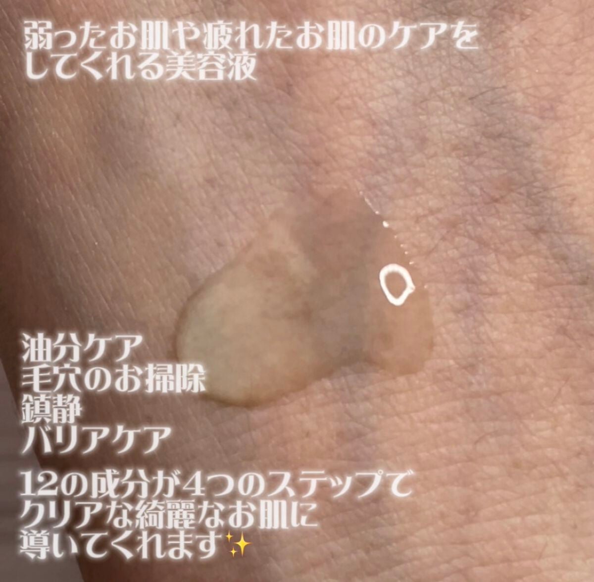 ビフィダシカハーブセラム/manyo/美容液を使ったクチコミ(2枚目)