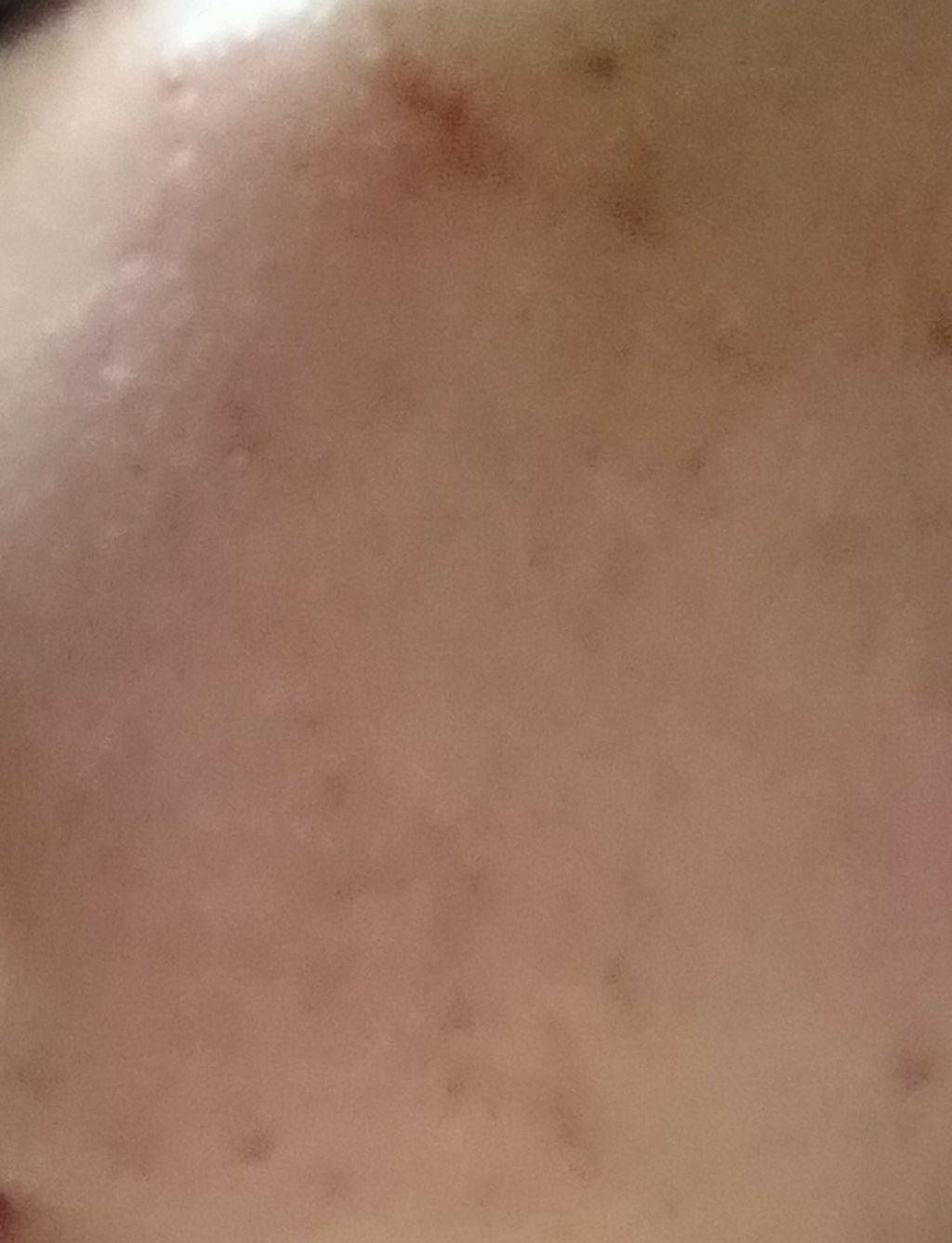 エクサージュホワイト ホワイトニング ピュア チャージャー/ALBION/美容液を使ったクチコミ（3枚目）