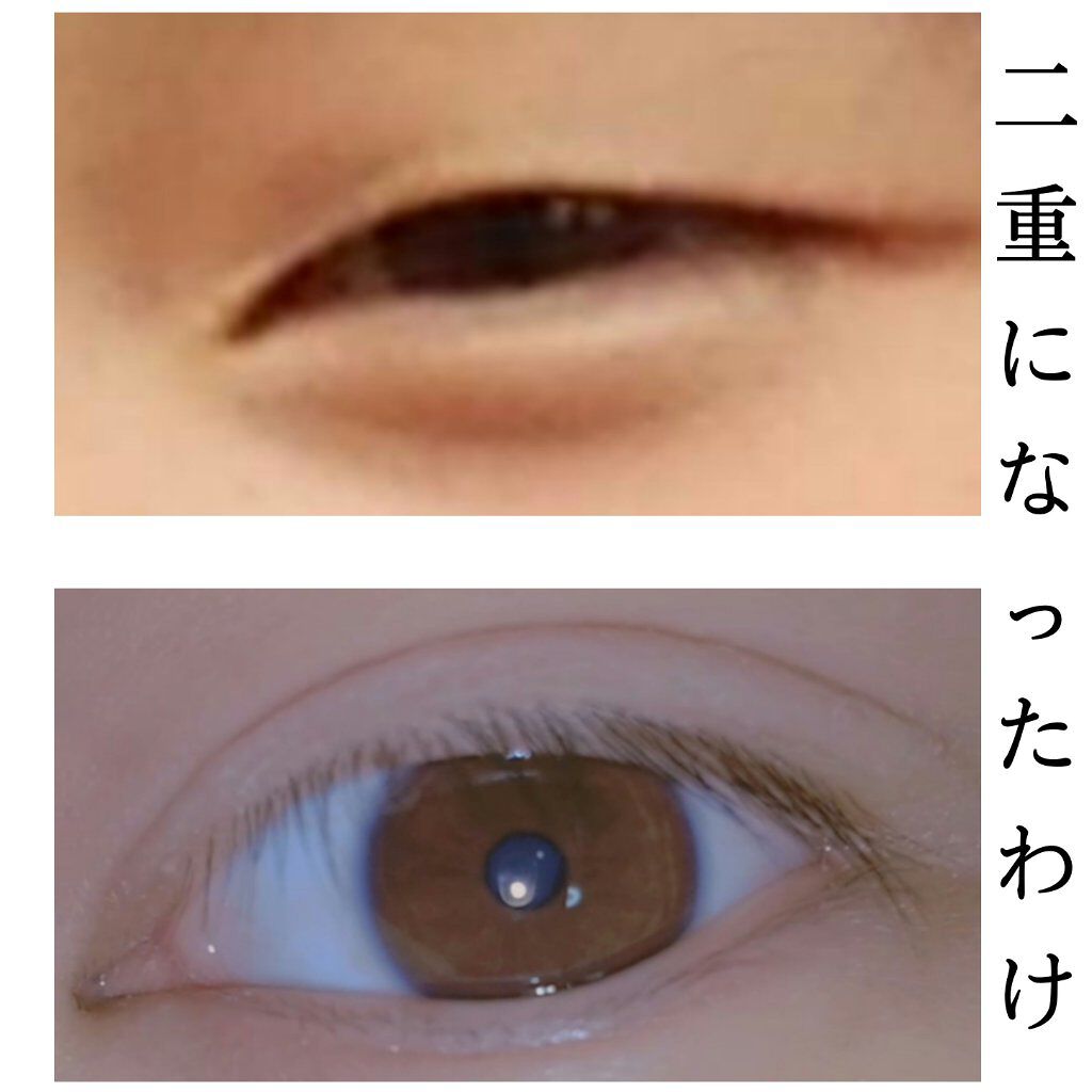 市場 ミセルg 二重になりたい 二重まぶた 二重になる方法 ミセル専用グループッシャー 二重のり 二重にする くっきり二重