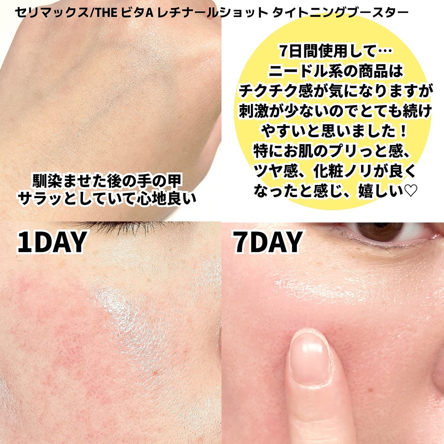 THE ビタA レチノールショット タイトニングセラム |celimaxの THE ビタA レチノールショット タイトニングセラム |celimaxの