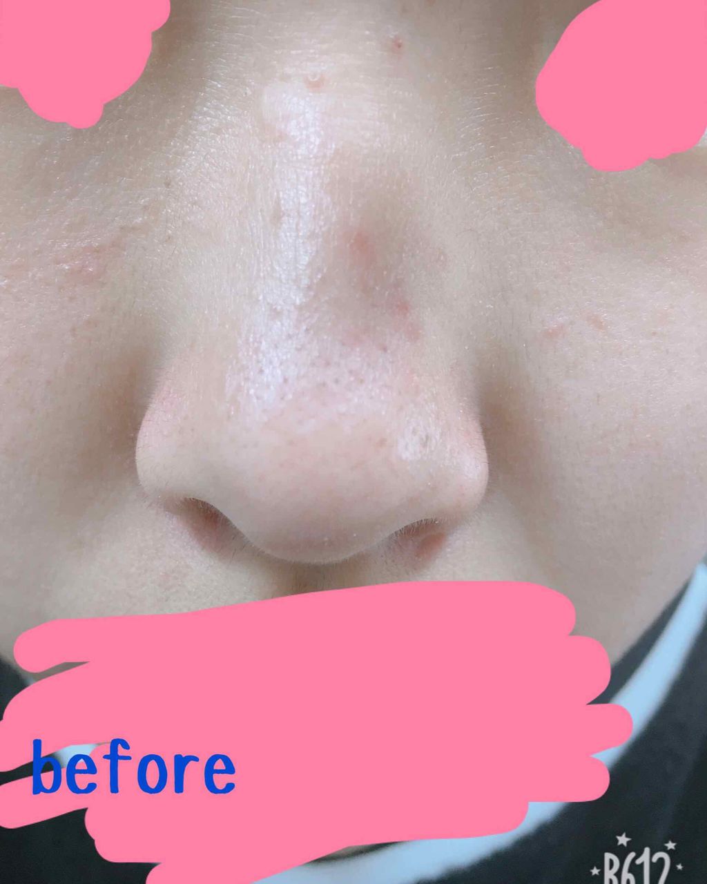 フェイスピーリングジェル ピーチの香り/DAISO/ピーリングを使ったクチコミ（3枚目）