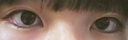 アイビューティー フィクサー WP/アストレア ヴィルゴ/二重まぶた用アイテムを使ったクチコミ(3枚目)