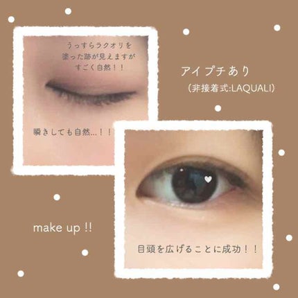 リキッドフィルム/ラクオリ/二重まぶた用アイテムを使ったクチコミ(4枚目)