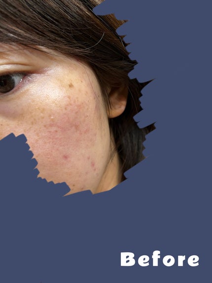 ベアプロ 16HR パウダー ファンデーション/bareMinerals/パウダーファンデーションを使ったクチコミ(2枚目)