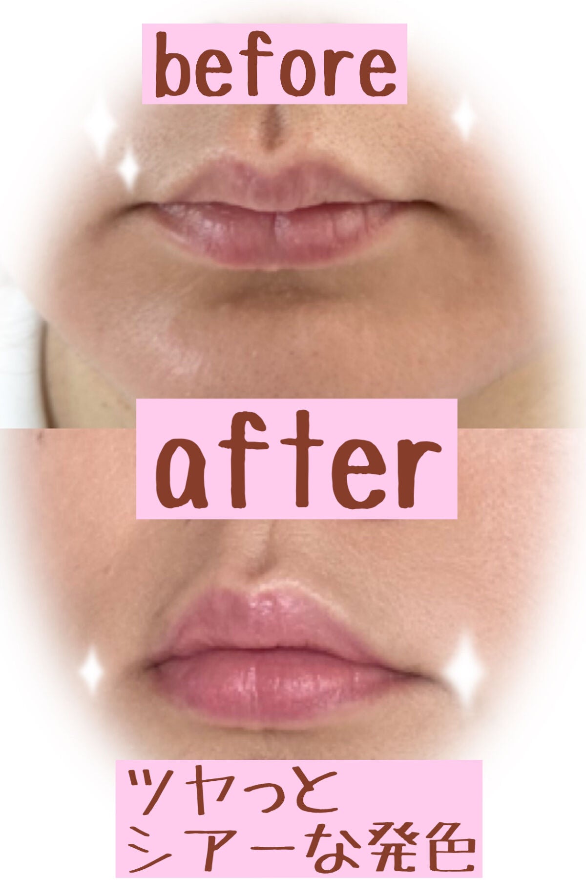 ブルーム リップ キャンディ ブリスフルブーケ/JILL STUART/口紅を使ったクチコミ(3枚目)