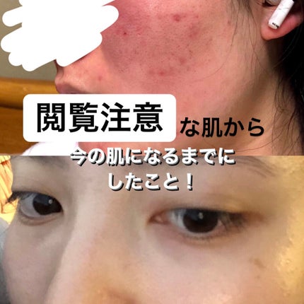 ハトムギオールインワンジェル/ハトムギ健康美人シリーズ/オールインワン化粧品を使ったクチコミ(1枚目)