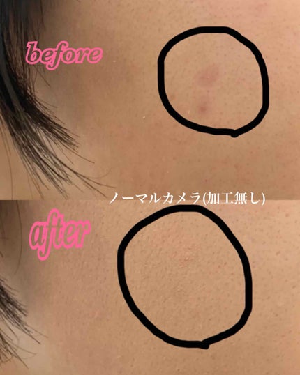 スポッツカバー ファウンデイション/SHISEIDO/クリームコンシーラーを使ったクチコミ(2枚目)