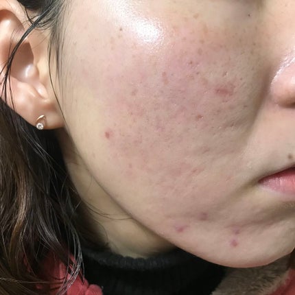 UVイデア XL プロテクショントーンアップ ローズ/ラ ロッシュ ポゼ/日焼け止めクリームを使ったクチコミ(2枚目)