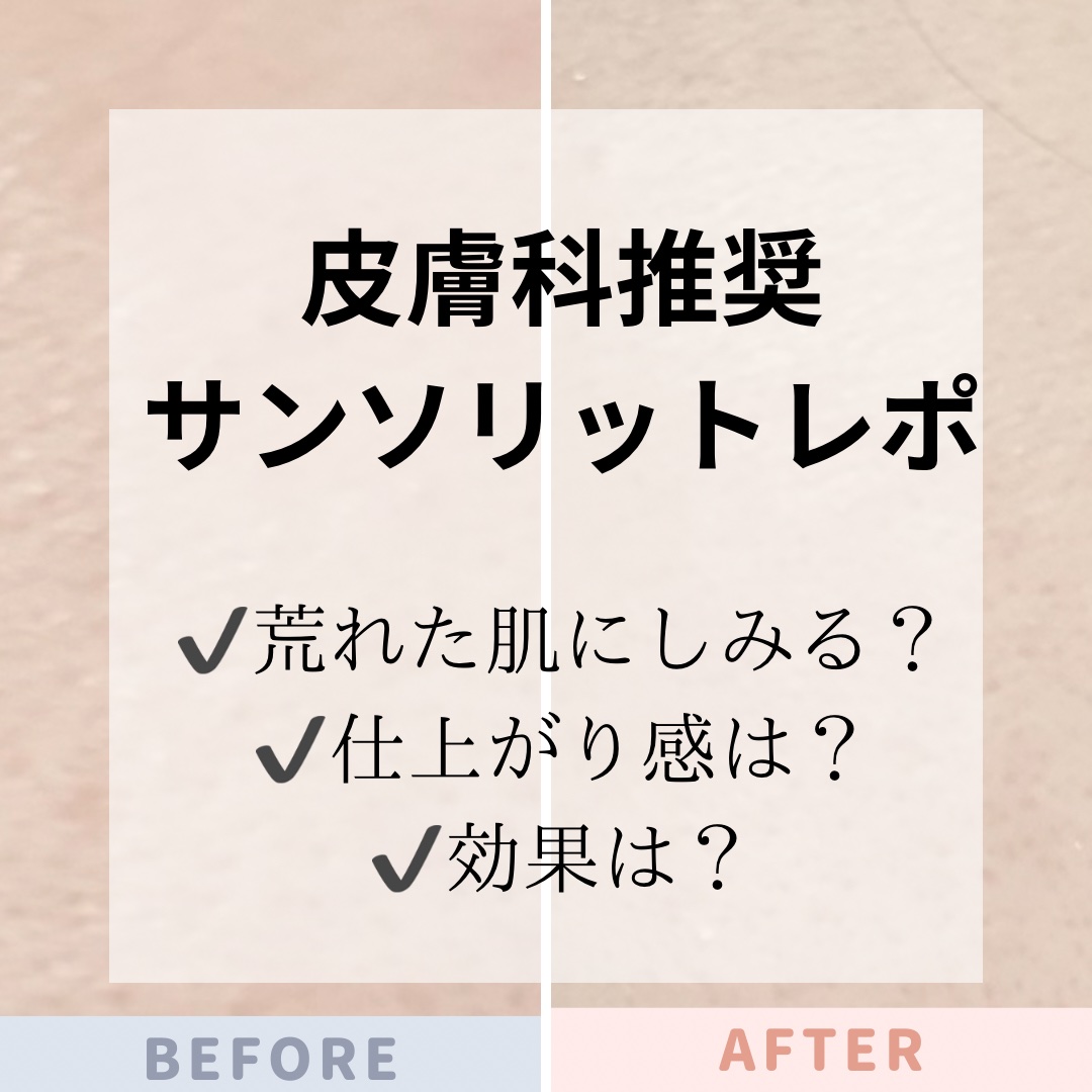 薬用 雪肌精 360ml/雪肌精/化粧水を使ったクチコミ（1枚目）