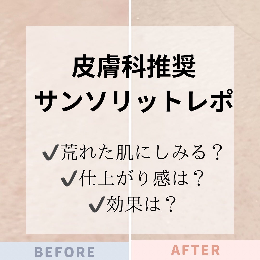 スキンピールバー ティートゥリー/サンソリット/洗顔石鹸を使ったクチコミ(1枚目)