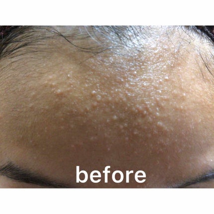 ME レギュラー 3/IPSA/化粧水を使ったクチコミ(2枚目)