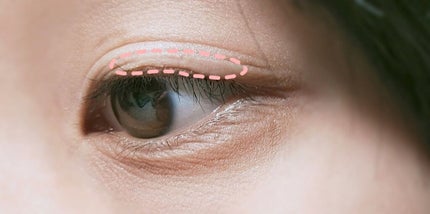 アイビューティー フィクサー WP/アストレア ヴィルゴ/二重まぶた用アイテムを使ったクチコミ(4枚目)