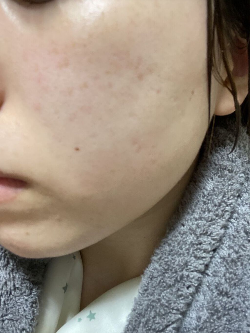 ホワイトニング エッセンス/アルージェ/美容液を使ったクチコミ（3枚目）