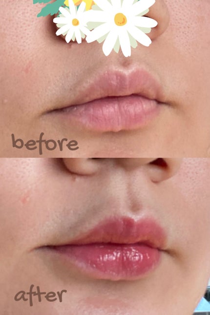 ジューシーラスティングティント/rom&nd/リップティントを使ったクチコミ(4枚目)