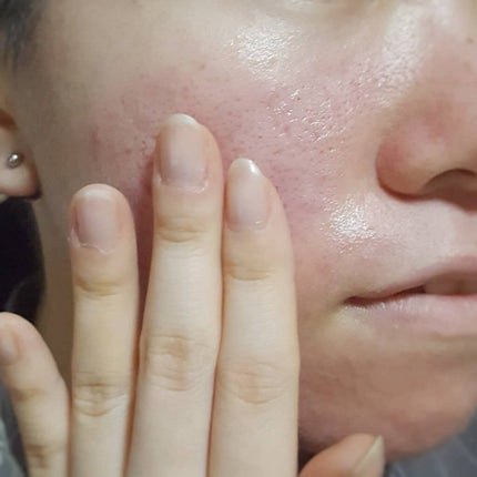 Ⅲ バリアコンセントレイト/NOV/美容液を使ったクチコミ(5枚目)