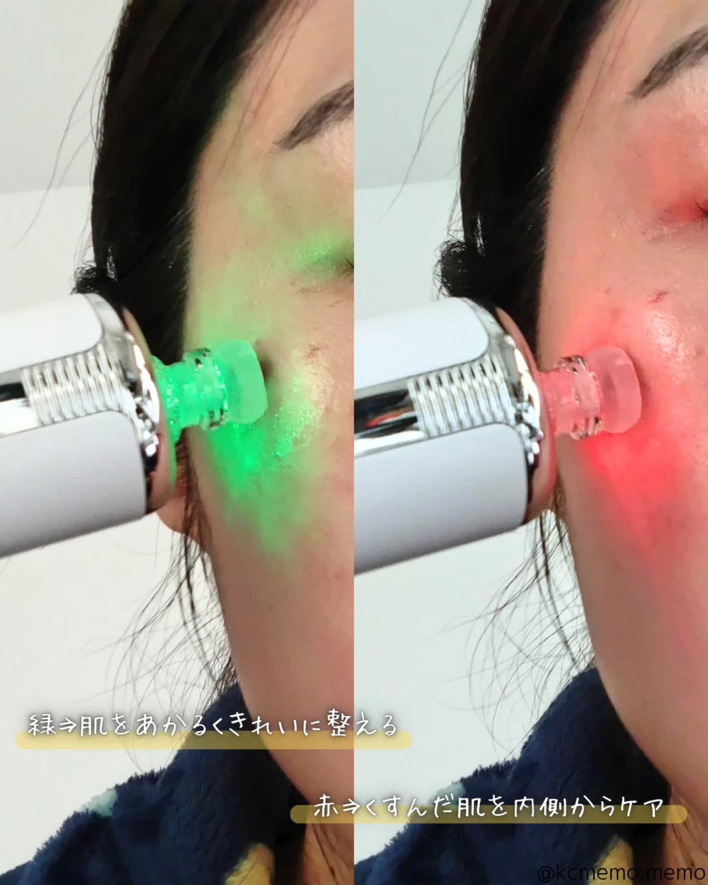 メリタンショットガン/セルオロジー/美顔器・マッサージを使ったクチコミ(7枚目)