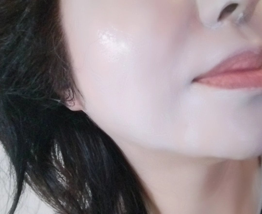 mcgroupakiko on LIPS 「【フルーツ酸ピーリング】といえば、スキンクリニックまで行ってと..」(3枚目)