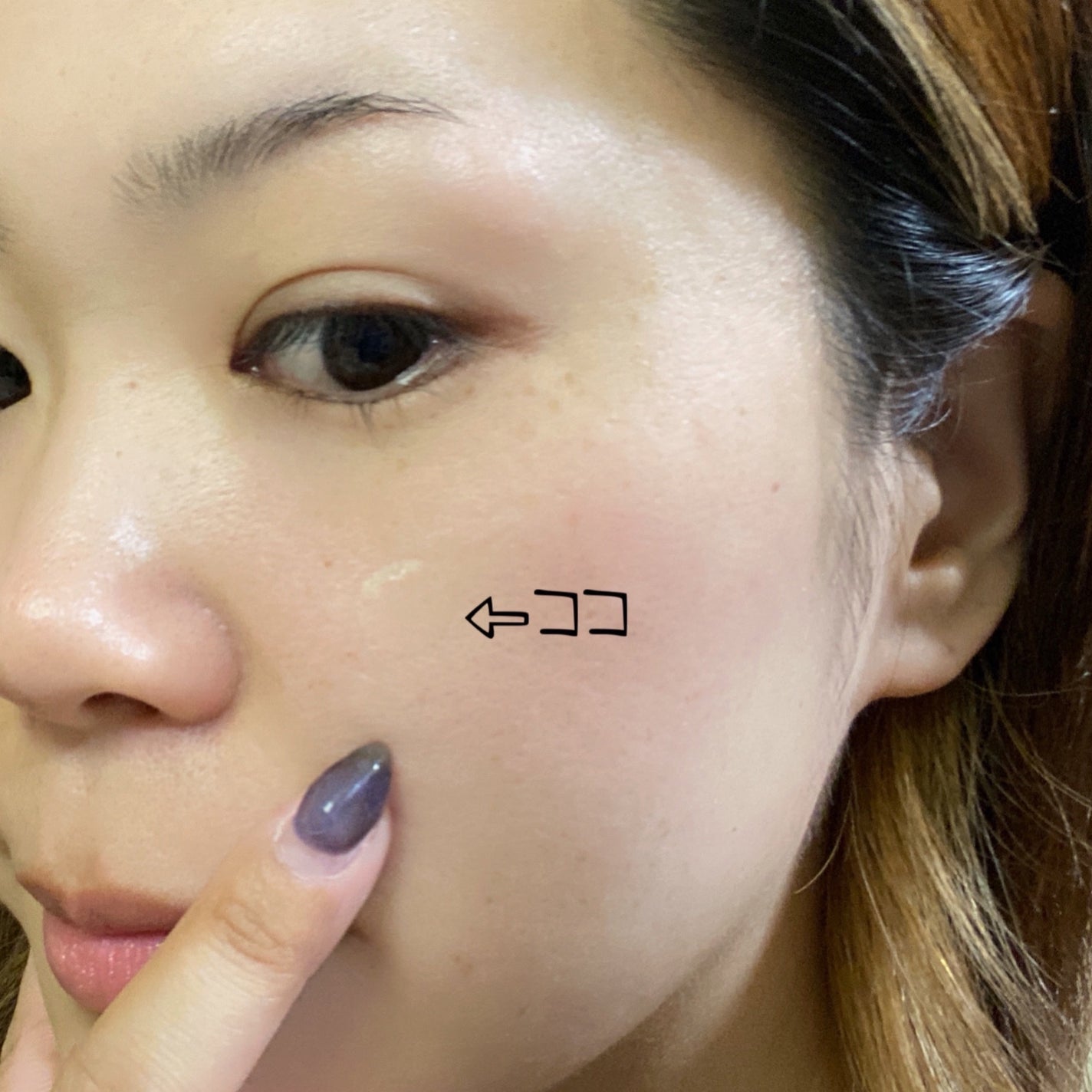 SPOT PATCH ロールタイプ/Shupong/にきびパッチを使ったクチコミ(6枚目)