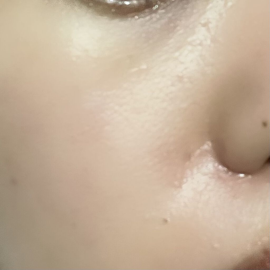 ドクダミ 77 スージングトナー/Anua/化粧水を使ったクチコミ（3枚目）