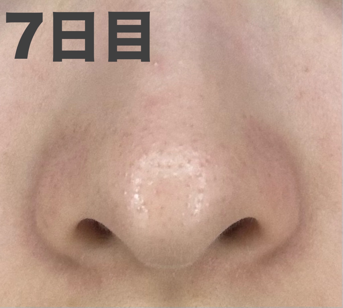 デュオ ザ ウォッシュ ブラックリペア/DUO/洗顔パウダーを使ったクチコミ（2枚目）