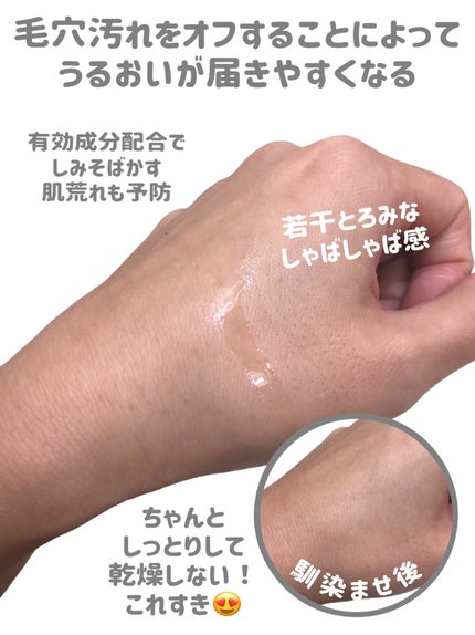 ネイチャーコンク 薬用クリアローション/ネイチャーコンク/拭き取り化粧水を使ったクチコミ(5枚目)