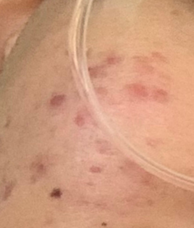 薬用しみ対策 美白化粧水/メラノCC/化粧水を使ったクチコミ(1枚目)