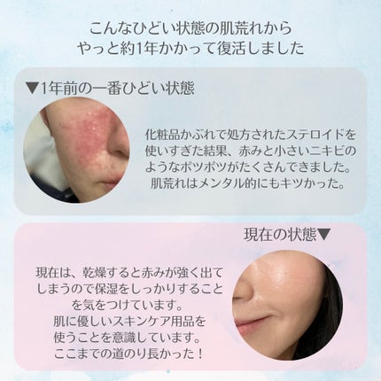 ベーシッククリーム/シェルクルール/クレンジングクリームを使ったクチコミ(2枚目)