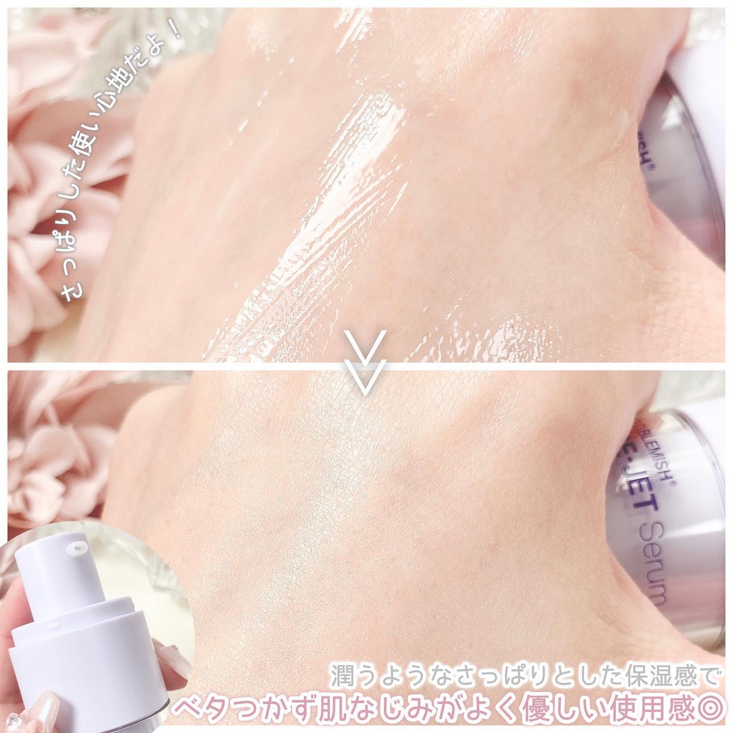 バクチオールポアジェットセラム/Dr.G/美容液を使ったクチコミ(4枚目)