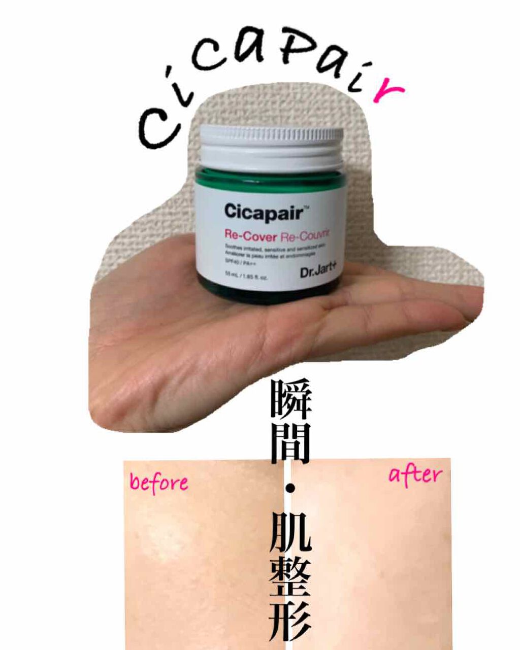 ドクタージャルト シカペア リカバー (第2世代）/Dr.Jart＋/フェイスクリームを使ったクチコミ（1枚目）