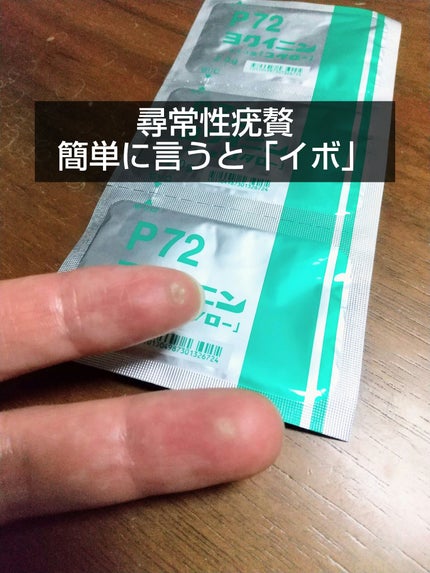 ヨクイニンエキス錠(医薬品)/コタローノカンポウヤク/その他を使ったクチコミ(1枚目)
