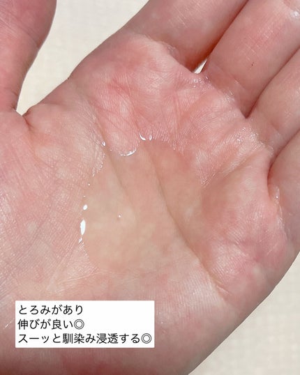 ダーマレーザー スーパーVC100ローション(しっとり)/クオリティファースト/化粧水を使ったクチコミ(3枚目)