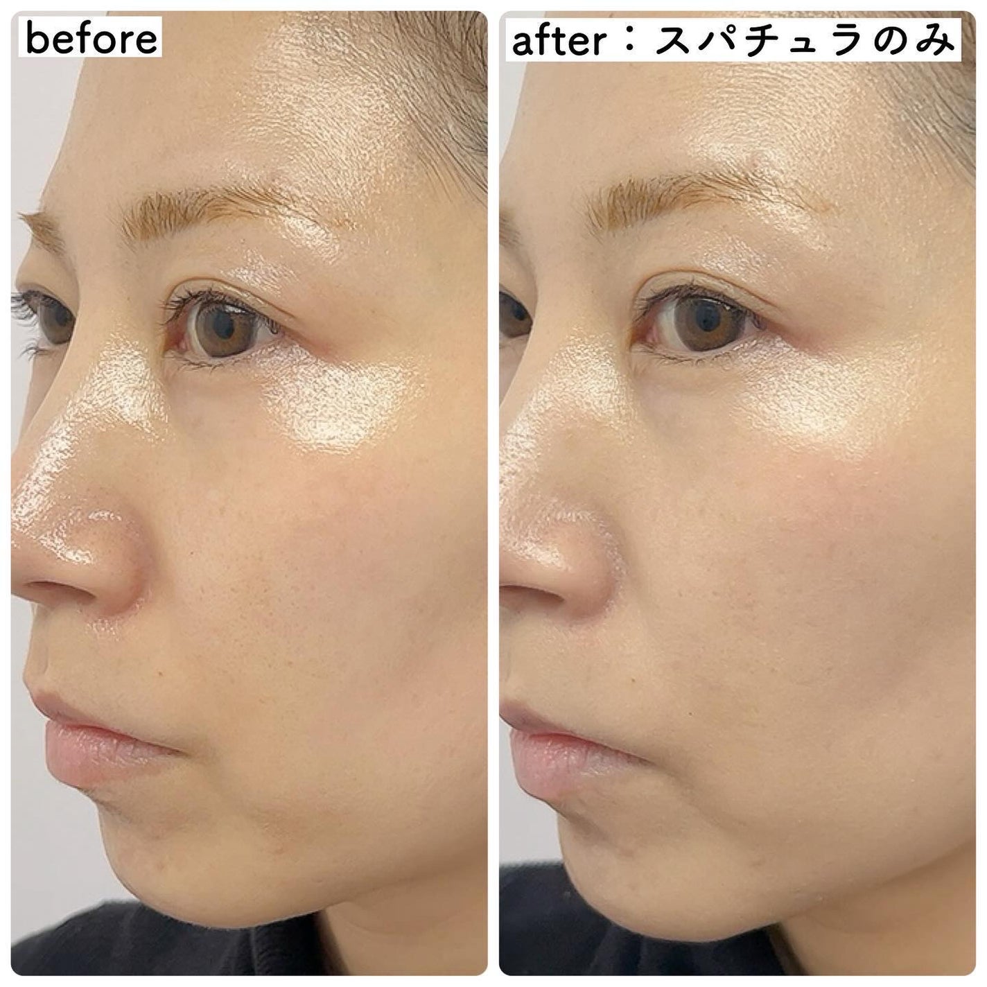 クリオ キル カバー スキン フィクサー クッション/CLIO/クッションファンデーションを使ったクチコミ(6枚目)