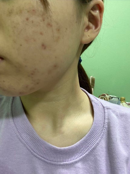 フローラドリップ/ALBION/化粧水を使ったクチコミ(3枚目)