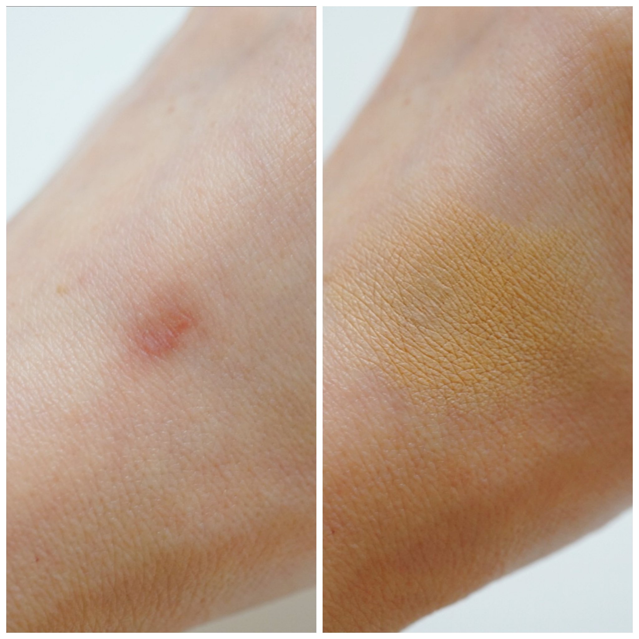 スポッツカバー ファウンデイション/SHISEIDO/クリームコンシーラーを使ったクチコミ（3枚目）