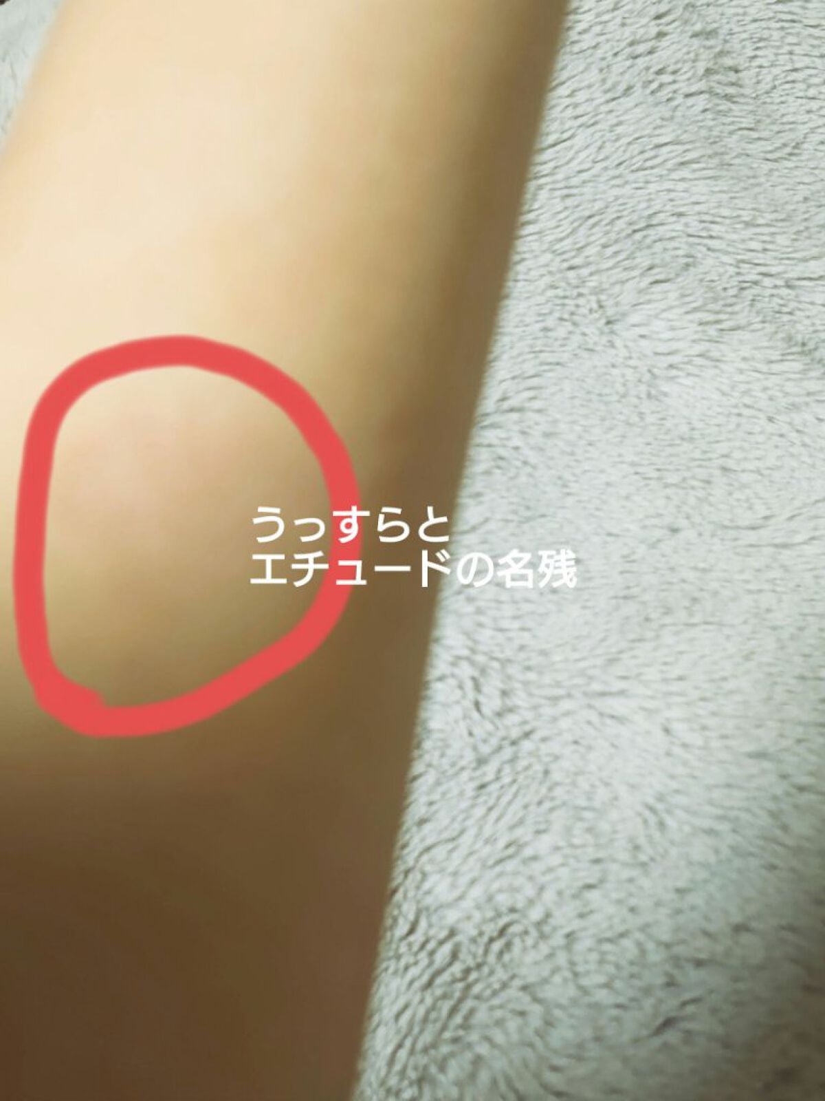 グラスティングウォーターティント/rom&nd/リップティントを使ったクチコミ(5枚目)