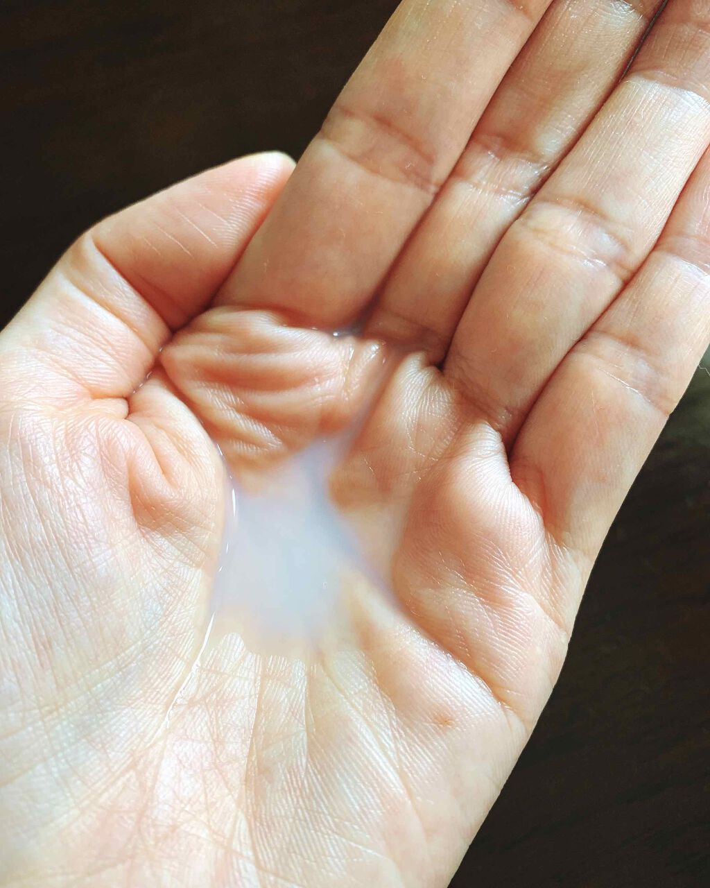 フローラドリップ/ALBION/化粧水を使ったクチコミ(2枚目)