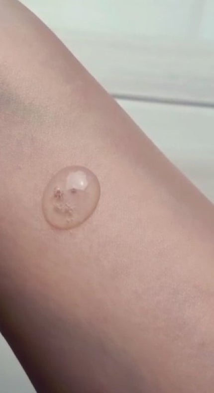 リードルショット300/VT/美容液を使ったクチコミ(5枚目)