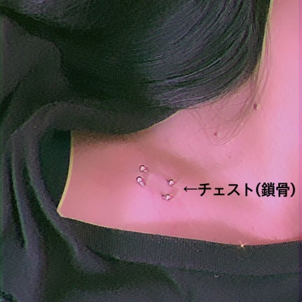 オロナインH軟膏 (医薬品)/オロナイン/その他を使ったクチコミ(4枚目)